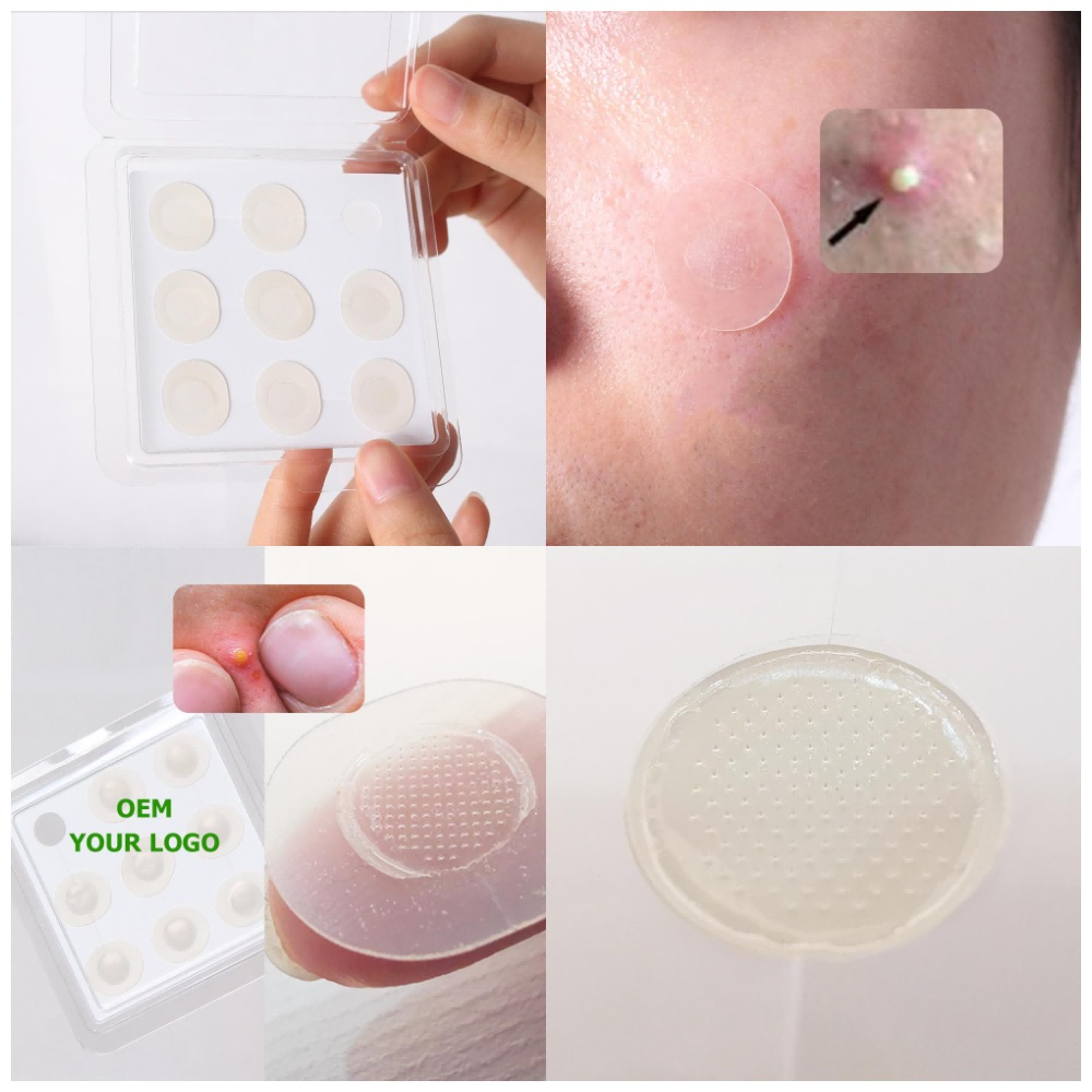 microneedle microneedle